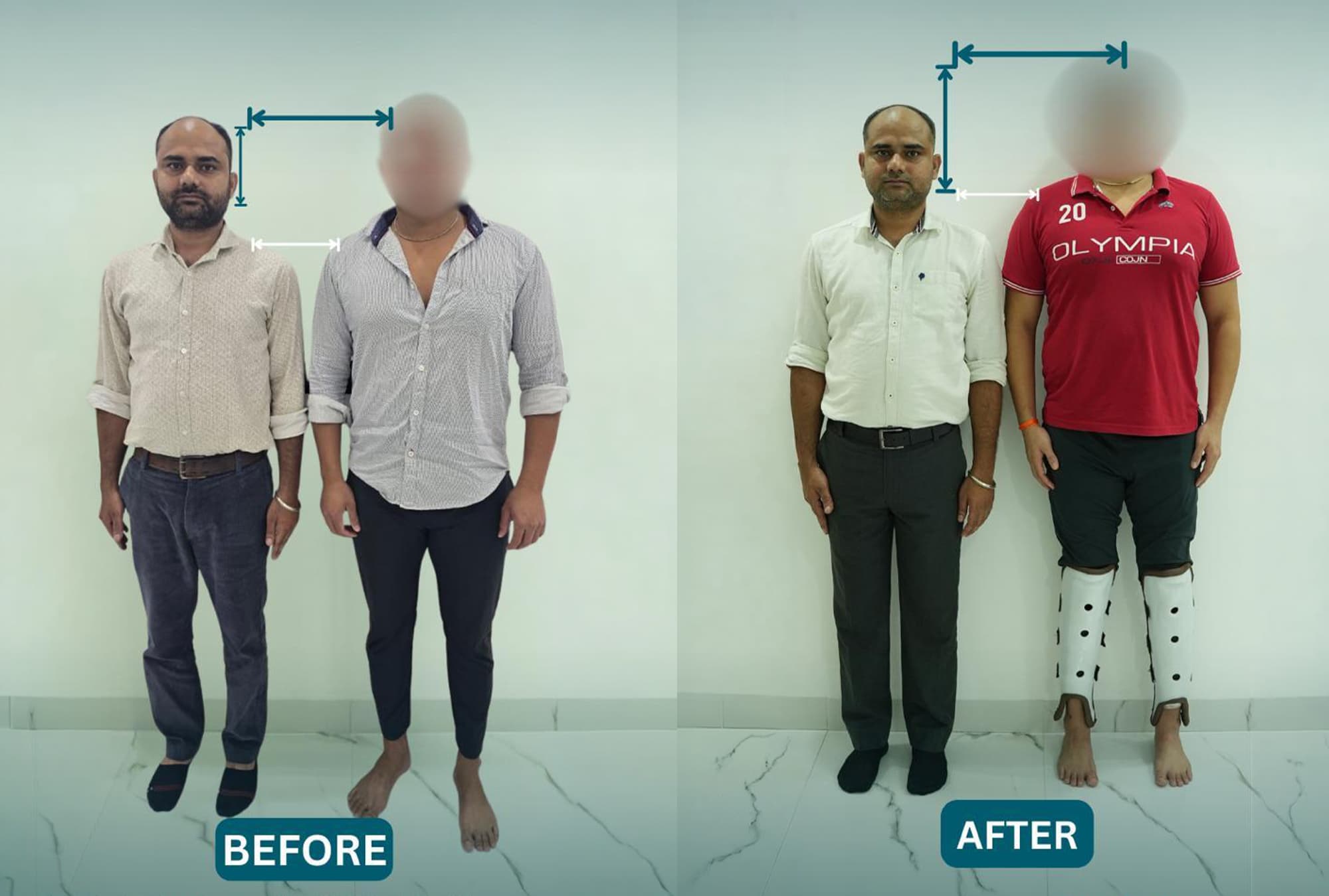 Case Study: Krishna Alignment Results