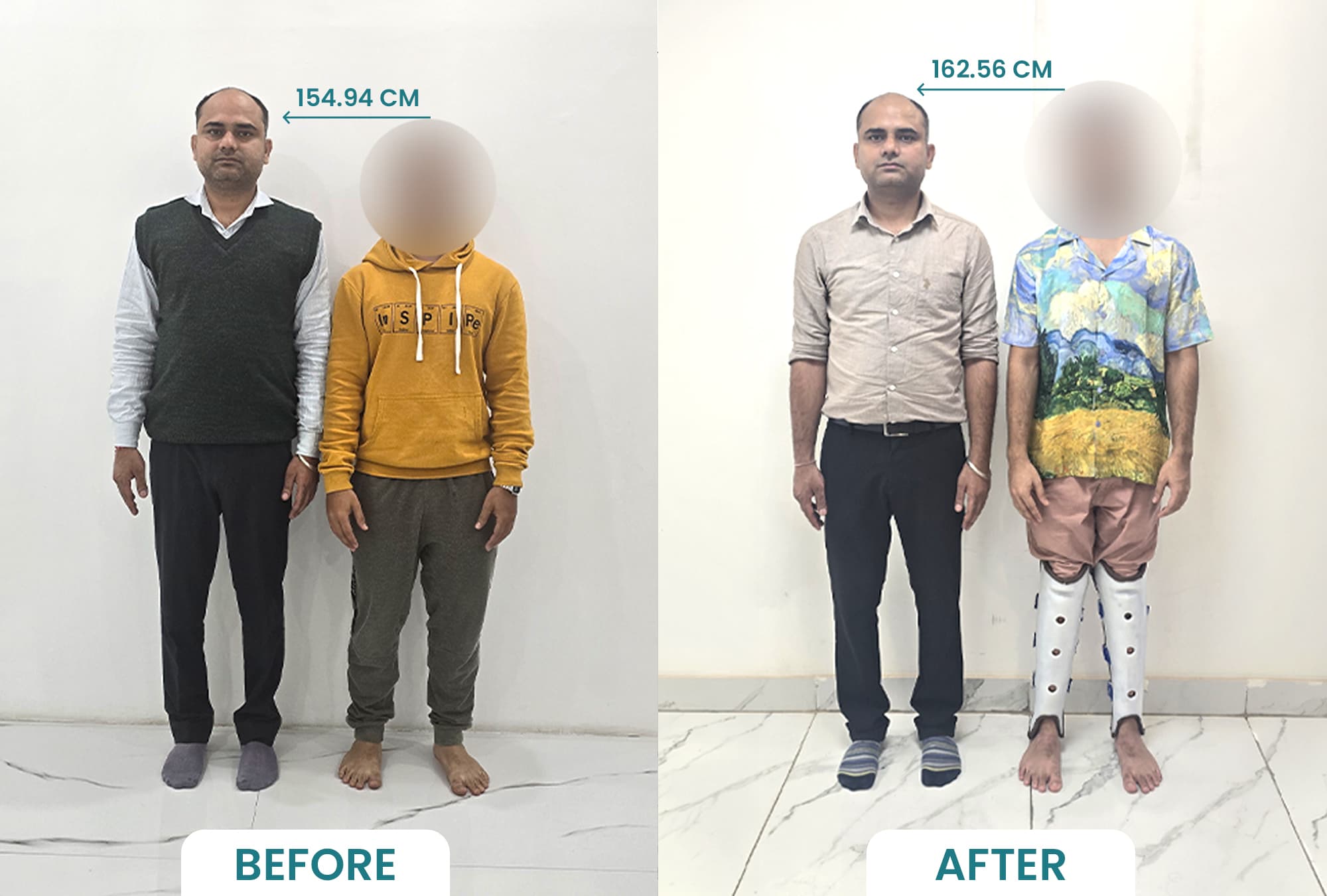 Case Study: Irfan Alignment Results